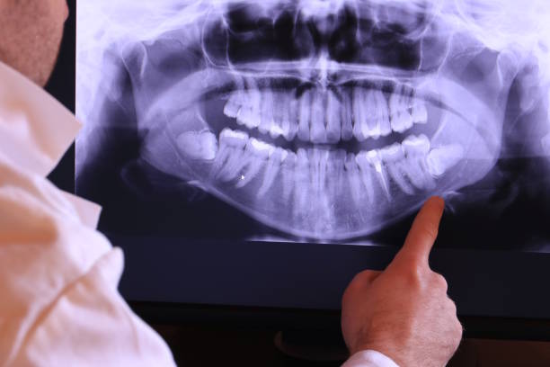 Best Emergency Denture Repair in Bren Bow, OK